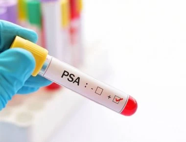 Προστάτης: Όλα όσα πρέπει να γνωρίζει κάθε άντρας